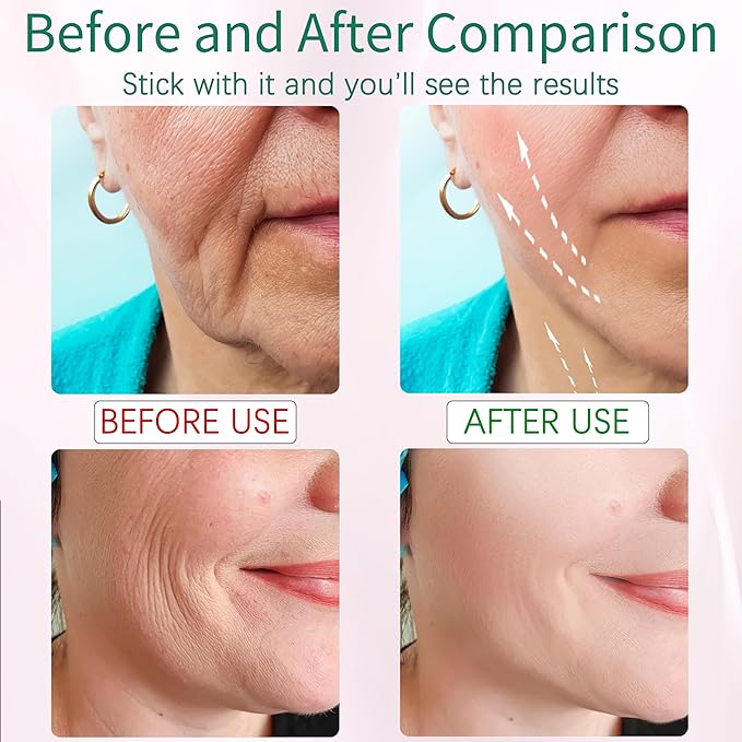 Neck Face Beauty Device Neckline